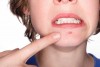 Ăn bánh trung thu có nổi mụn không? Có ảnh hưởng sức khỏe?